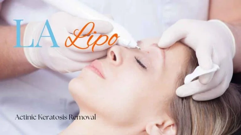 Woman receiving Actinic Keratosis Removal Treatment Queensbury