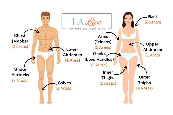 LA LIPO Cryolipolysis Areas Queensbury