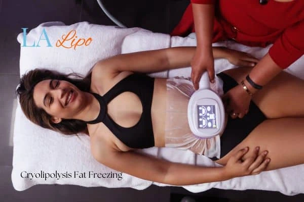 woman getting cryolipolysis Queensbury