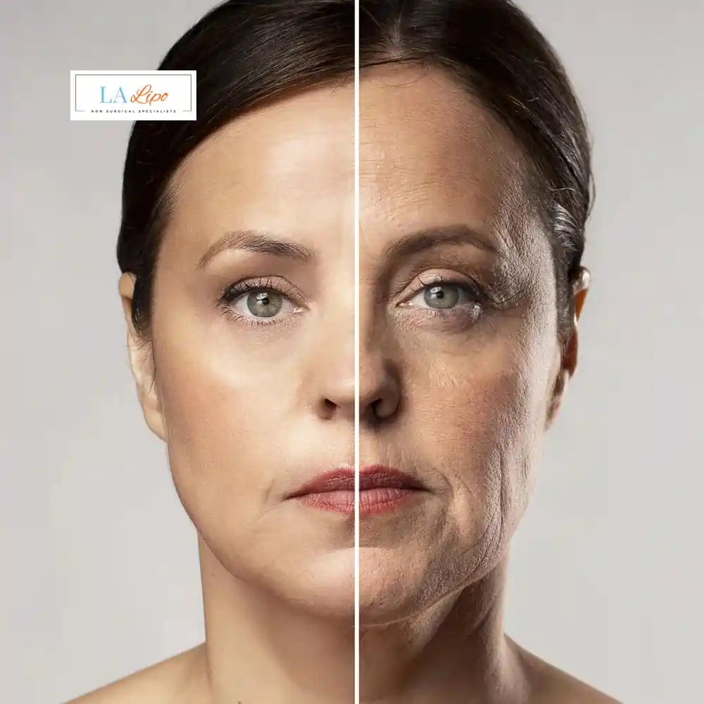 How Can You Tell If Non-Surgical Skin Tightening Is Right for You Queensbury?