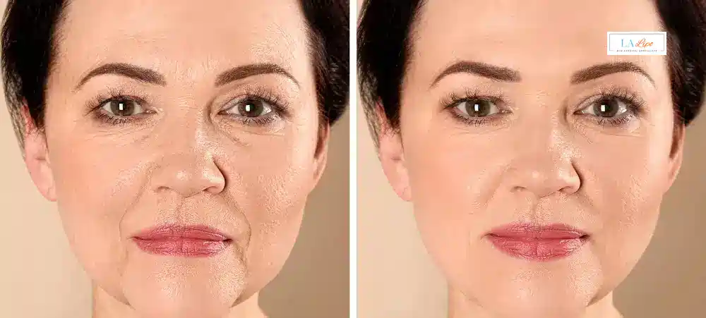 How Long Does It Take to See Results and How Long Do They Last Queensbury?