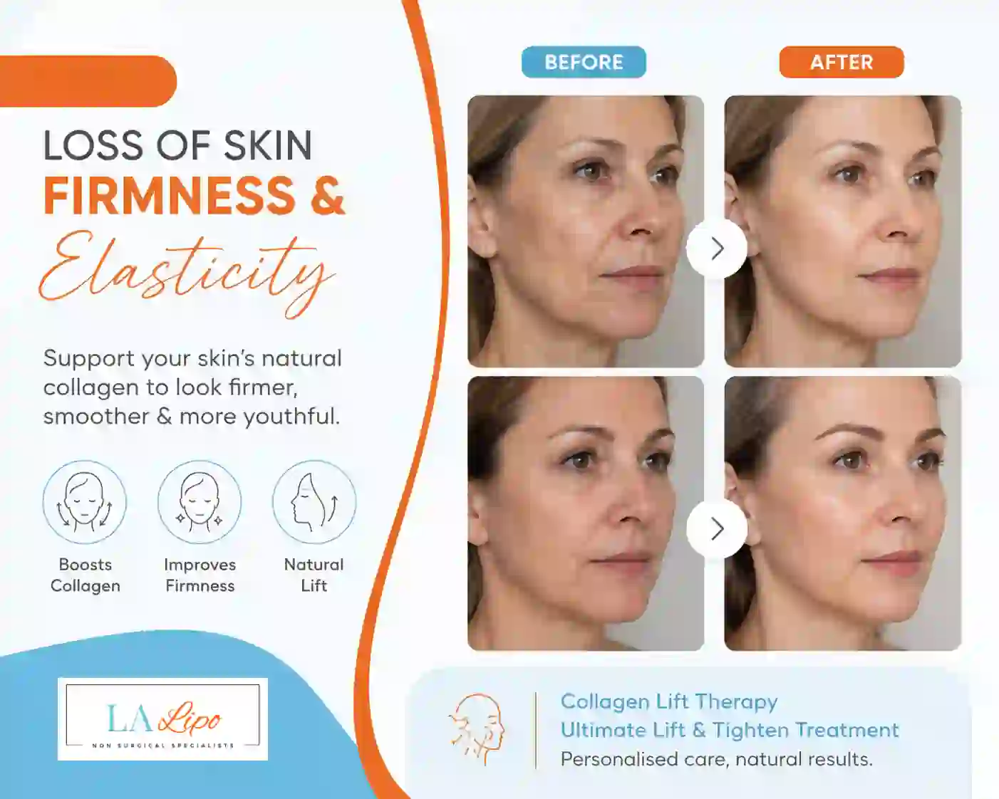 Sign #7: Loss of Skin Firmness and Elasticity Queensbury