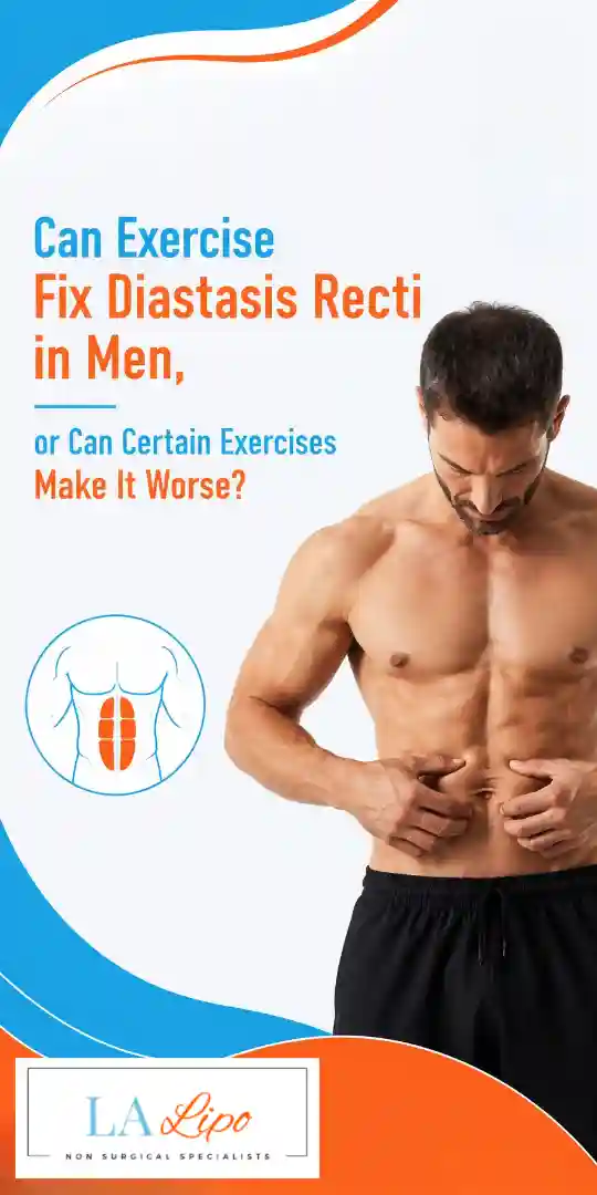 Can Exercise Fix Diastasis Recti in Men, or Can Certain Exercises Make It Worse Queensbury?